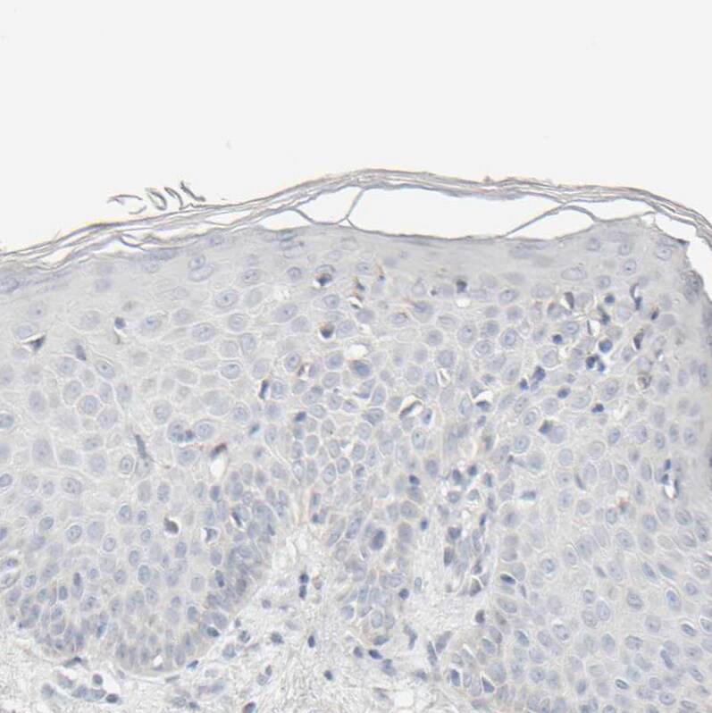 HRSP12 Antibody - BSA Free Immunohistochemistry-Paraffin: HRSP12 Antibody [NBP1-82452]