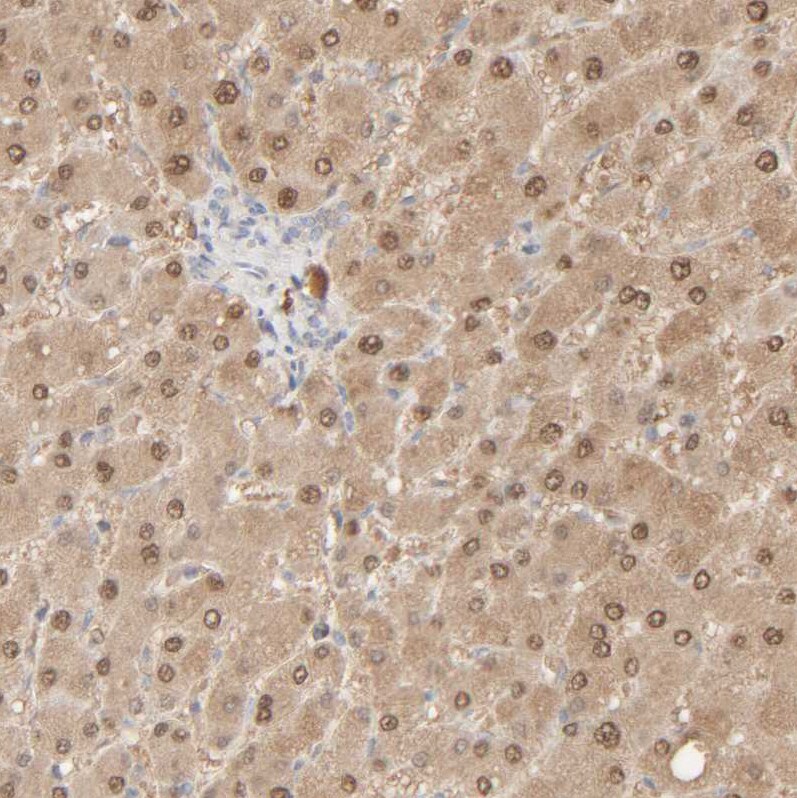 HRSP12 Antibody - BSA Free Immunohistochemistry-Paraffin: HRSP12 Antibody [NBP1-82452]