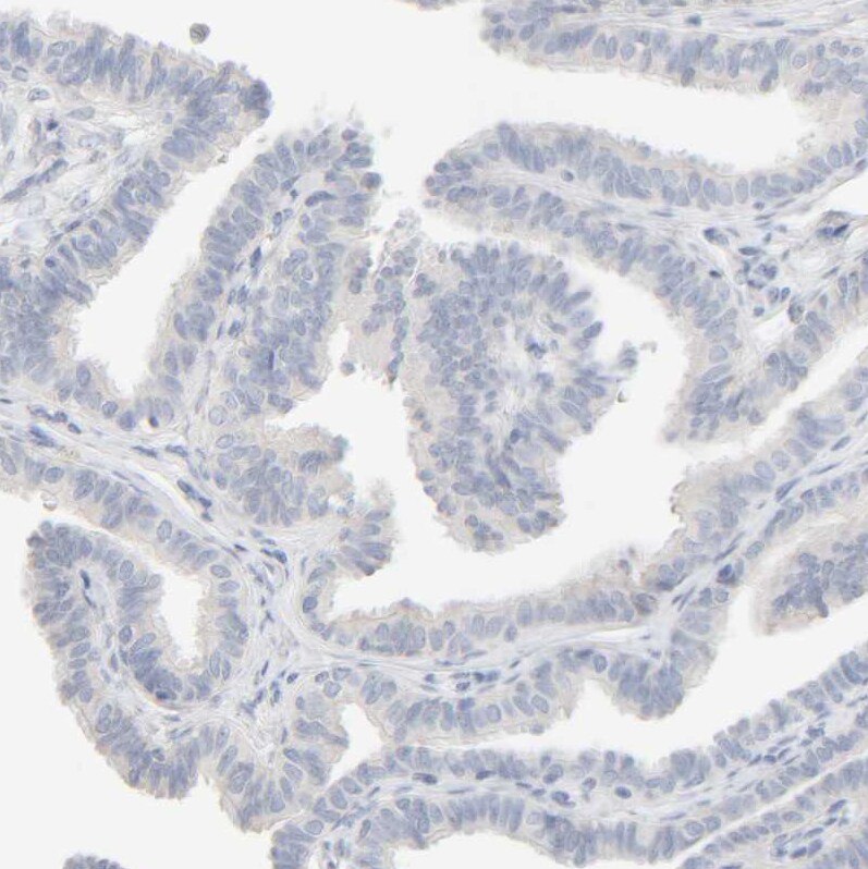 HRSP12 Antibody - BSA Free Immunohistochemistry-Paraffin: HRSP12 Antibody [NBP1-82452]