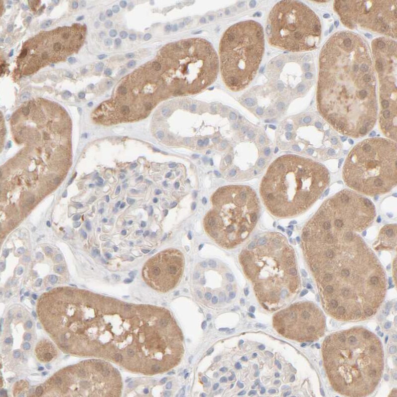 HRSP12 Antibody - BSA Free Immunohistochemistry-Paraffin: HRSP12 Antibody [NBP1-82452]
