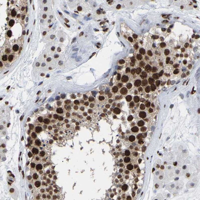 p130 Antibody - BSA Free Immunohistochemistry-Paraffin: p130 Antibody [NBP1-82455]