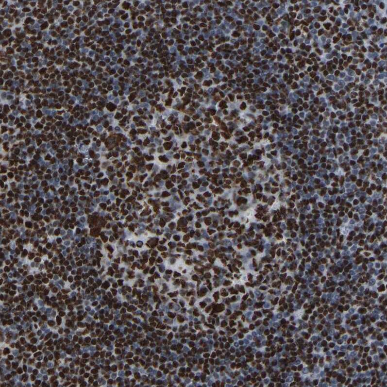 p130 Antibody - BSA Free Immunohistochemistry-Paraffin: p130 Antibody [NBP1-82455]
