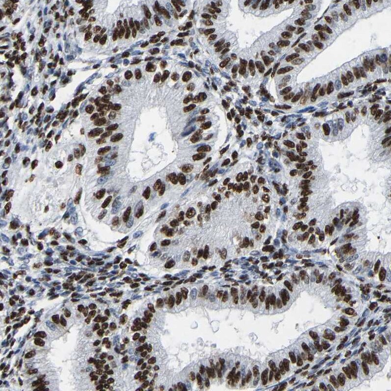 p130 Antibody - BSA Free Immunohistochemistry-Paraffin: p130 Antibody [NBP1-82455]