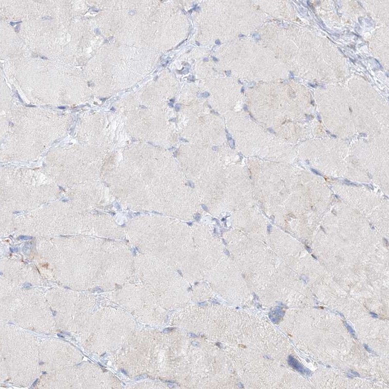 SEC23IP Antibody - BSA Free Immunohistochemistry-Paraffin: SEC23IP Antibody [NBP1-82456]