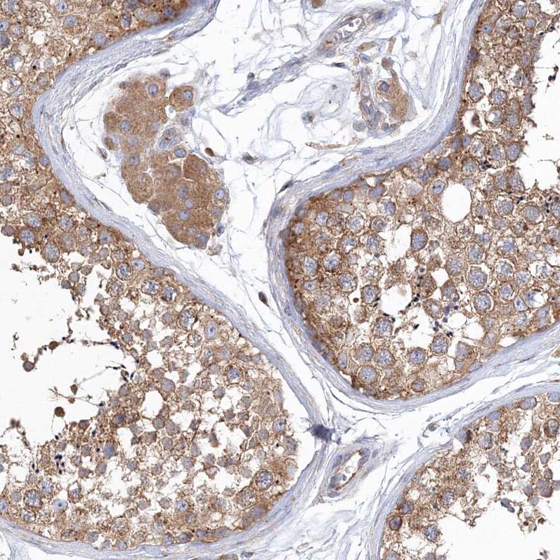 SEC23IP Antibody - BSA Free Immunohistochemistry-Paraffin: SEC23IP Antibody [NBP1-82456]
