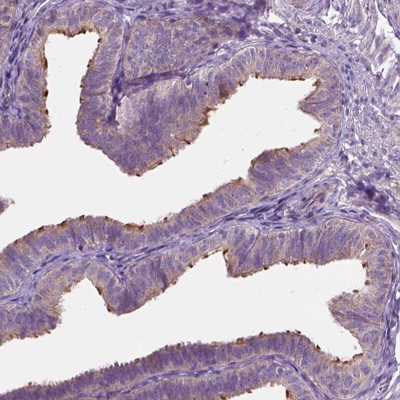 TTC29 Antibody Immunohistochemistry: TTC29 Antibody [NBP1-80983]