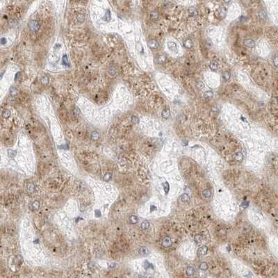 Ribophorin I Antibody - BSA Free Immunohistochemistry-Paraffin: Ribophorin I Antibody [NBP1-82467]