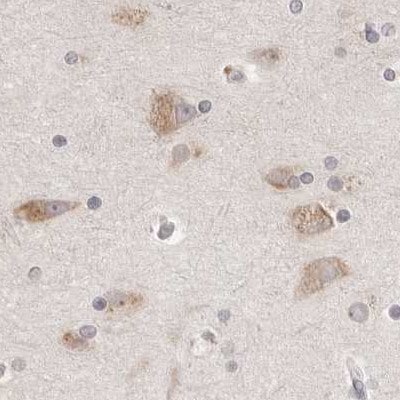 Ribophorin I Antibody - BSA Free Immunohistochemistry-Paraffin: Ribophorin I Antibody [NBP1-82467]