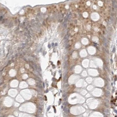 Ribophorin I Antibody - BSA Free Immunohistochemistry-Paraffin: Ribophorin I Antibody [NBP1-82467]