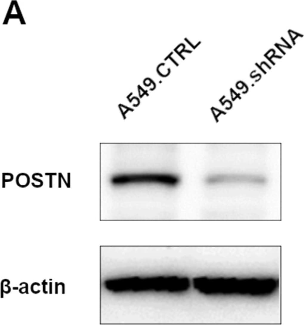 Periostin/OSF-2 Antibody