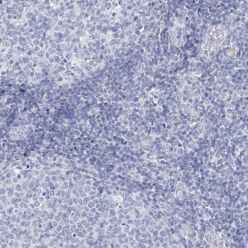 OSBPL6 Antibody - BSA Free Immunohistochemistry-Paraffin: OSBPL6 Antibody [NBP1-82475]