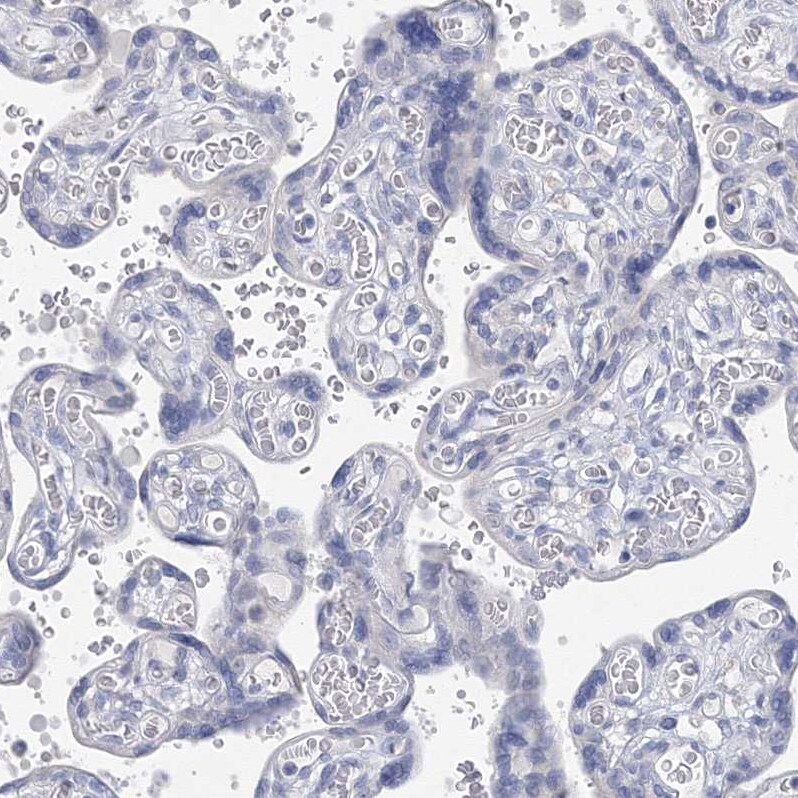OSBPL6 Antibody - BSA Free Immunohistochemistry-Paraffin: OSBPL6 Antibody [NBP1-82475]