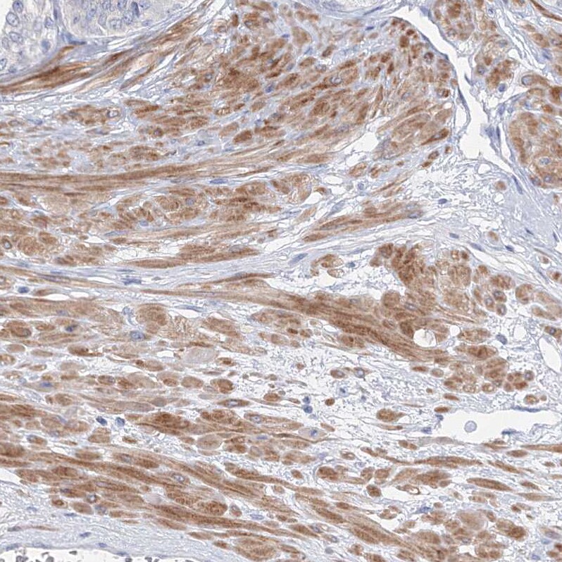 OSBPL6 Antibody - BSA Free Immunohistochemistry-Paraffin: OSBPL6 Antibody [NBP1-82475]