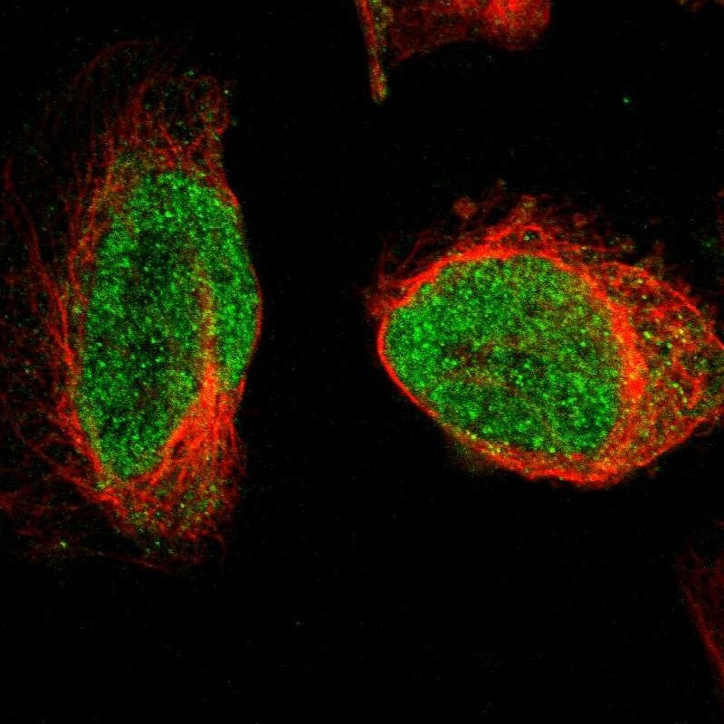 ORC5L Antibody - BSA Free Immunocytochemistry/ Immunofluorescence: ORC5L Antibody [NBP1-82476]
