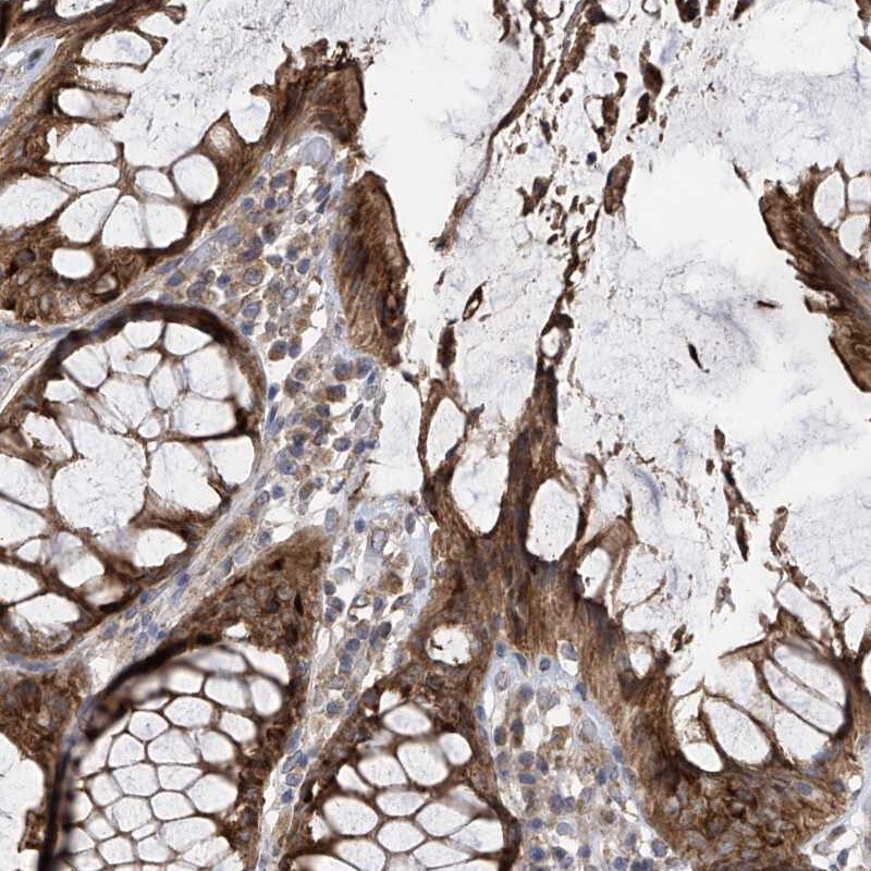 PNPT1 Antibody - BSA Free Immunohistochemistry-Paraffin: PNPT1 Antibody [NBP1-82485]