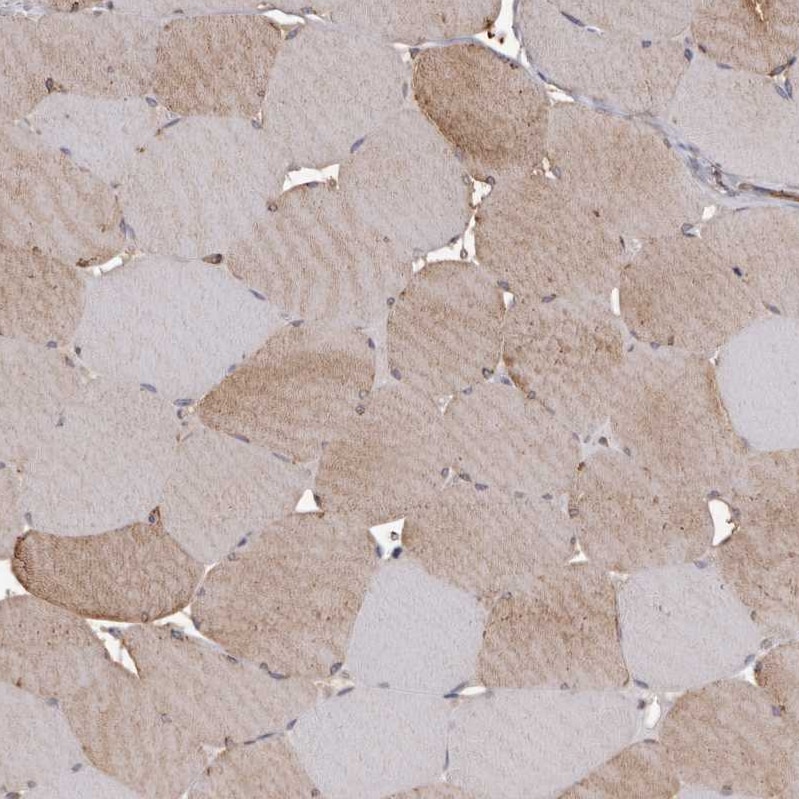 PKM2 Antibody - BSA Free Immunohistochemistry-Paraffin: PKM2 Antibody [NBP1-82487]