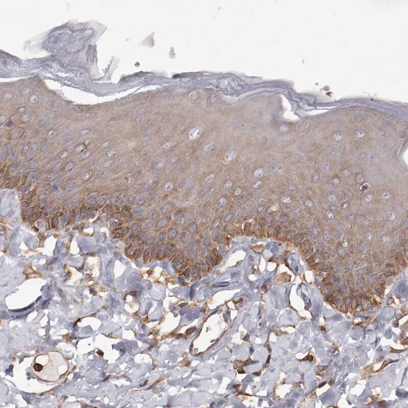 PKM2 Antibody - BSA Free Immunohistochemistry-Paraffin: PKM2 Antibody [NBP1-82487]