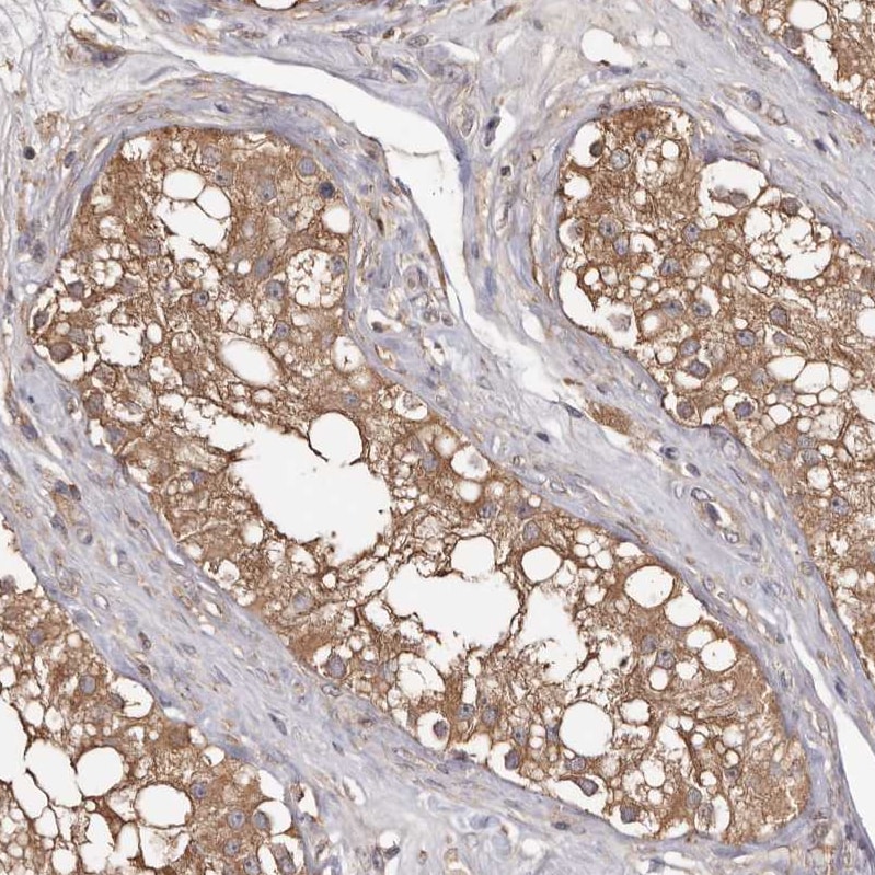 PKM2 Antibody - BSA Free Immunohistochemistry-Paraffin: PKM2 Antibody [NBP1-82487]