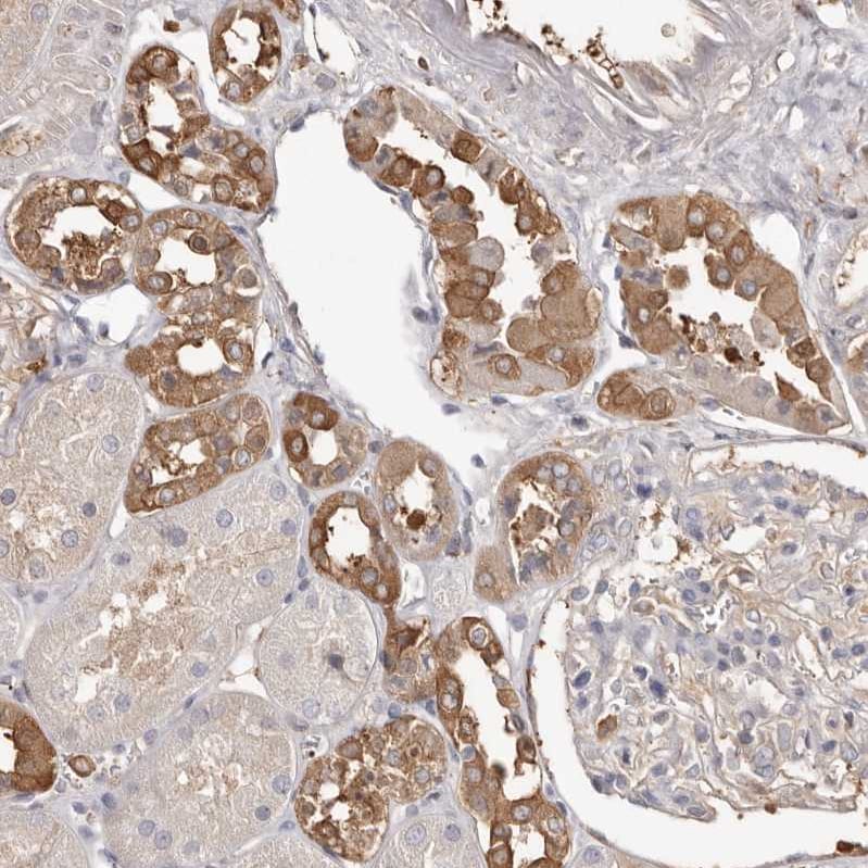 PKM2 Antibody - BSA Free Immunohistochemistry-Paraffin: PKM2 Antibody [NBP1-82487]