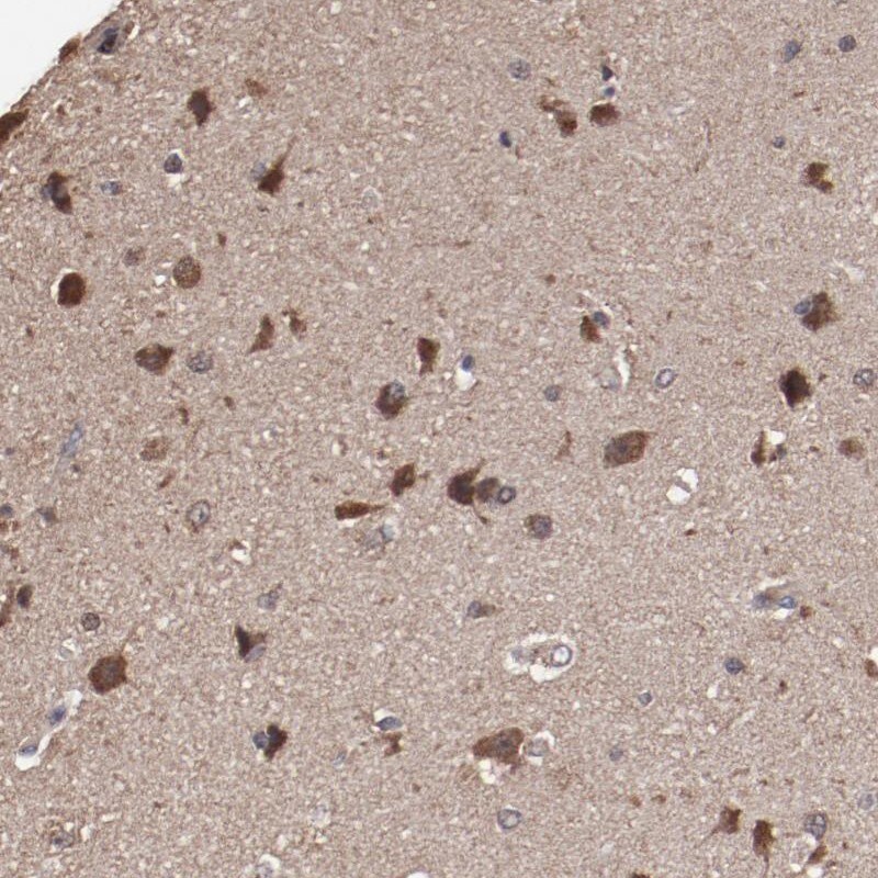 ODZ3 Antibody Immunohistochemistry-Paraffin: Septin-11 Antibody [NBP1-82491]