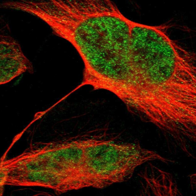 MLF2 Antibody - BSA Free Immunocytochemistry/ Immunofluorescence: MLF2 Antibody [NBP1-82518]
