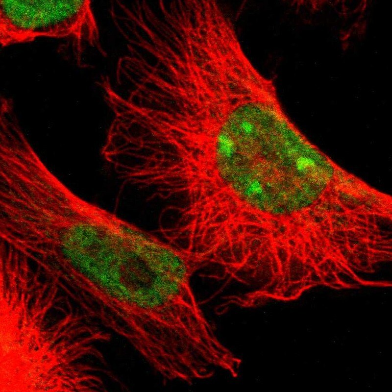 ADAR Antibody Immunocytochemistry/ Immunofluorescence: ADAR Antibody [NBP1-90242]
