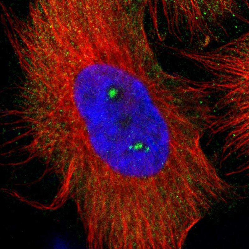 p67phox/NOXA2 Antibody - BSA Free Immunocytochemistry/ Immunofluorescence: p67phox/NOXA2 Antibody [NBP1-82542]