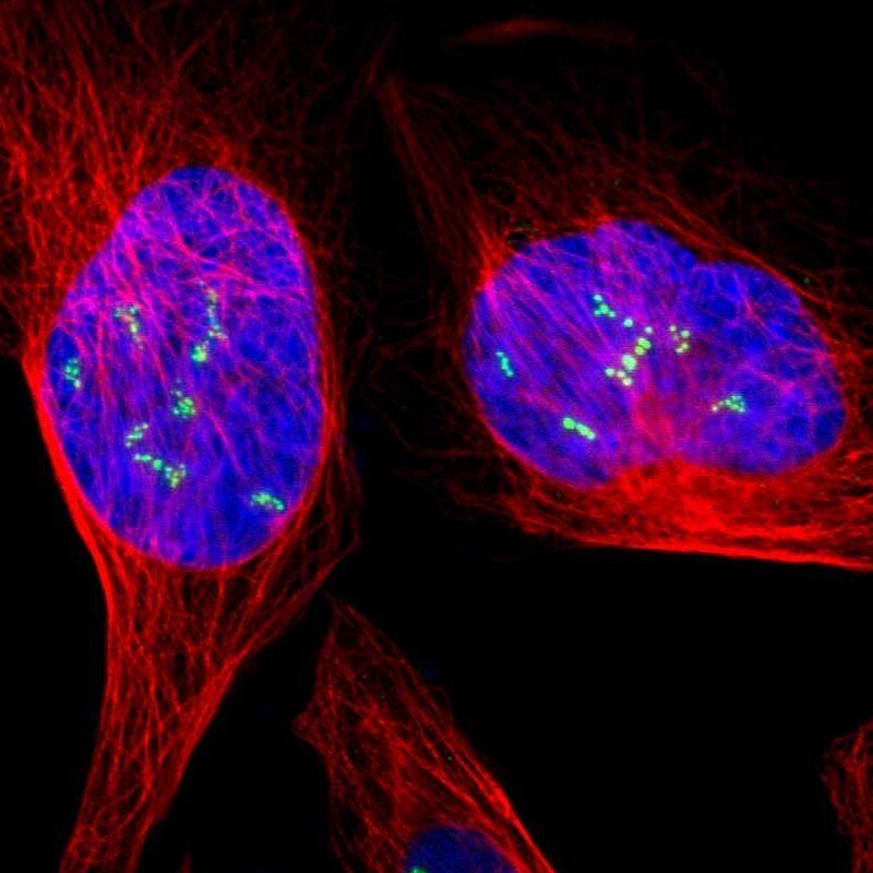 UBTF Antibody - BSA Free Immunocytochemistry/ Immunofluorescence: UBTF Antibody [NBP1-82545]