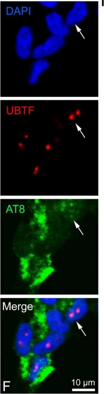 UBTF Antibody - BSA Free