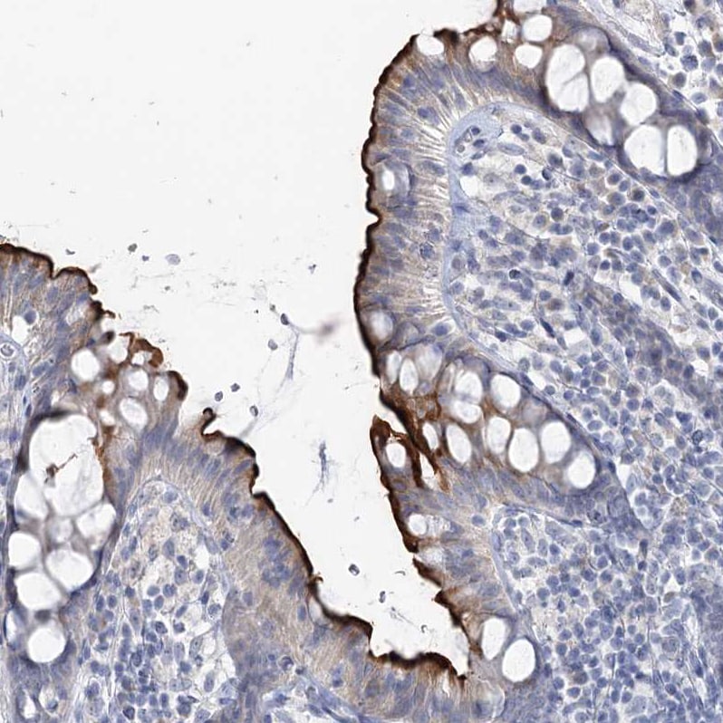NHE3/SLC9A3 Antibody - BSA Free Immunohistochemistry-Paraffin: NHE3/SLC9A3 Antibody [NBP1-82574]