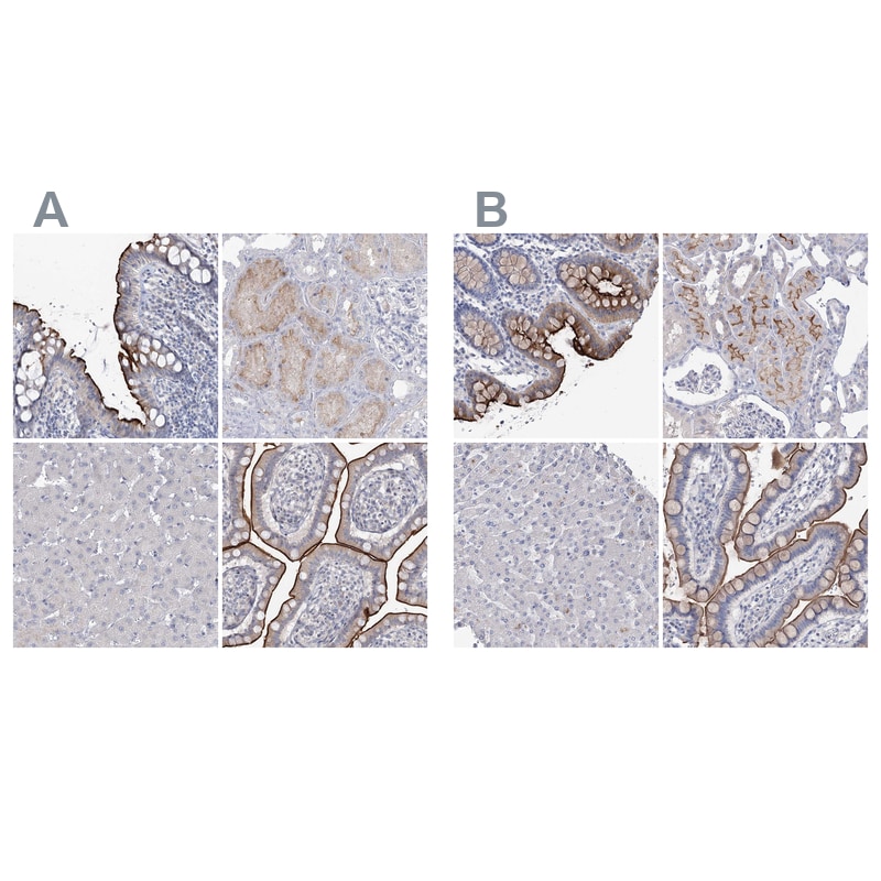 NHE3/SLC9A3 Antibody - BSA Free Immunohistochemistry-Paraffin: NHE3/SLC9A3 Antibody [NBP1-82574]