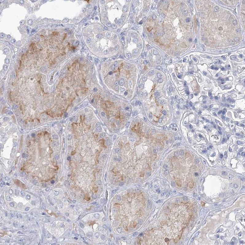 NHE3/SLC9A3 Antibody - BSA Free Immunohistochemistry-Paraffin: NHE3/SLC9A3 Antibody [NBP1-82574]