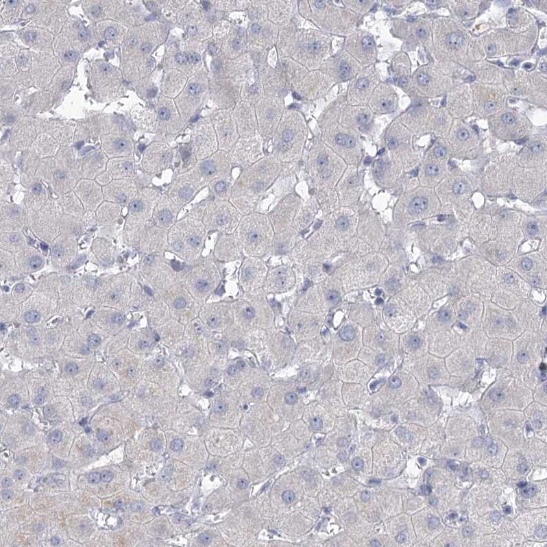 NHE3/SLC9A3 Antibody - BSA Free Immunohistochemistry-Paraffin: NHE3/SLC9A3 Antibody [NBP1-82574]