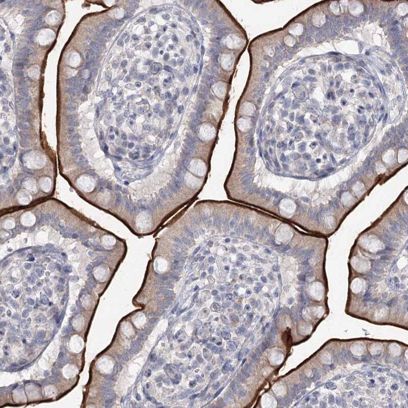 NHE3/SLC9A3 Antibody - BSA Free Immunohistochemistry-Paraffin: NHE3/SLC9A3 Antibody [NBP1-82574]