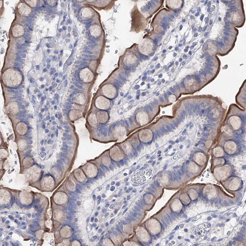 NHE3/SLC9A3 Antibody - BSA Free Immunohistochemistry-Paraffin: NHE3/SLC9A3 Antibody [NBP1-82575]