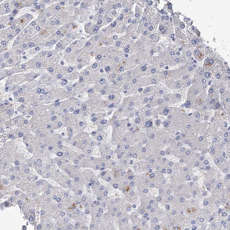NHE3/SLC9A3 Antibody - BSA Free Immunohistochemistry-Paraffin: NHE3/SLC9A3 Antibody [NBP1-82575]