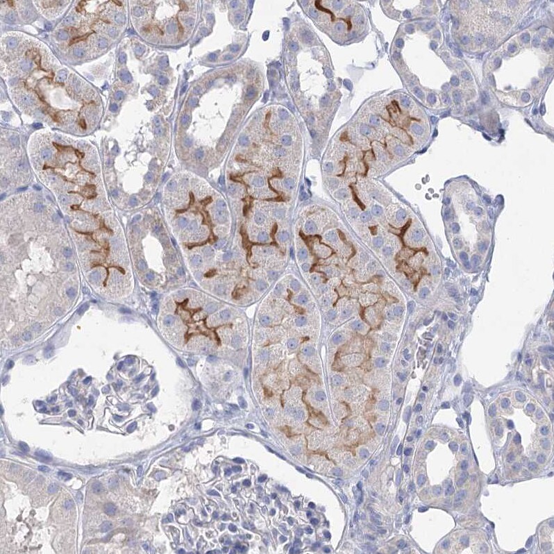 NHE3/SLC9A3 Antibody - BSA Free Immunohistochemistry-Paraffin: NHE3/SLC9A3 Antibody [NBP1-82575]