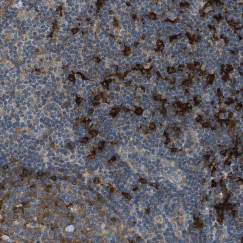 SAMSN1 Antibody - BSA Free Immunohistochemistry-Paraffin: SAMSN1 Antibody [NBP1-82598]