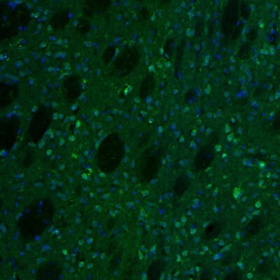 alpha-N-acetylglucosaminidase/NAGLU Antibody - BSA Free Immunohistochemistry: alpha-N-acetylglucosaminidase/NAGLU Antibody - BSA Free [NBP1-82601]