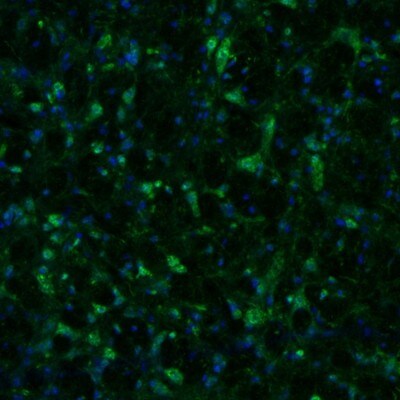 alpha-N-acetylglucosaminidase/NAGLU Antibody - BSA Free Immunohistochemistry: alpha-N-acetylglucosaminidase/NAGLU Antibody - BSA Free [NBP1-82601]