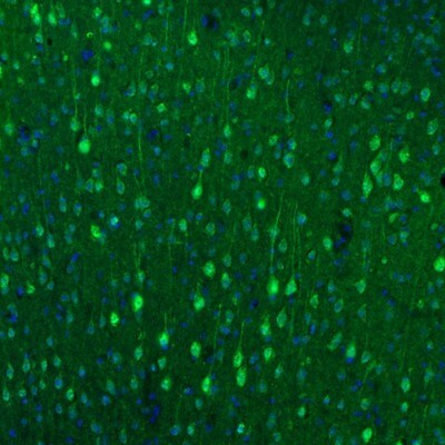 alpha-N-acetylglucosaminidase/NAGLU Antibody - BSA Free Immunohistochemistry: alpha-N-acetylglucosaminidase/NAGLU Antibody - BSA Free [NBP1-82601]