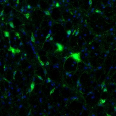 alpha-N-acetylglucosaminidase/NAGLU Antibody - BSA Free Immunohistochemistry: alpha-N-acetylglucosaminidase/NAGLU Antibody - BSA Free [NBP1-82601]