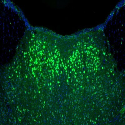 alpha-N-acetylglucosaminidase/NAGLU Antibody - BSA Free Immunohistochemistry: alpha-N-acetylglucosaminidase/NAGLU Antibody - BSA Free [NBP1-82601]