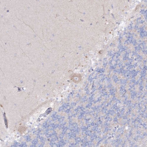 alpha-N-acetylglucosaminidase/NAGLU Antibody - BSA Free Immunohistochemistry: alpha-N-acetylglucosaminidase/NAGLU Antibody - BSA Free [NBP1-82601]