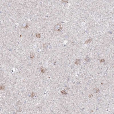 alpha-N-acetylglucosaminidase/NAGLU Antibody - BSA Free Immunohistochemistry: alpha-N-acetylglucosaminidase/NAGLU Antibody - BSA Free [NBP1-82601]