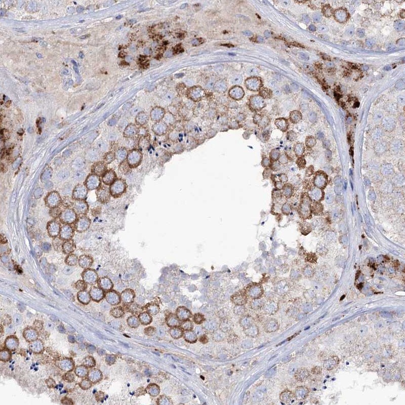 alpha-N-acetylglucosaminidase/NAGLU Antibody - BSA Free Immunohistochemistry: alpha-N-acetylglucosaminidase/NAGLU Antibody - BSA Free [NBP1-82601]