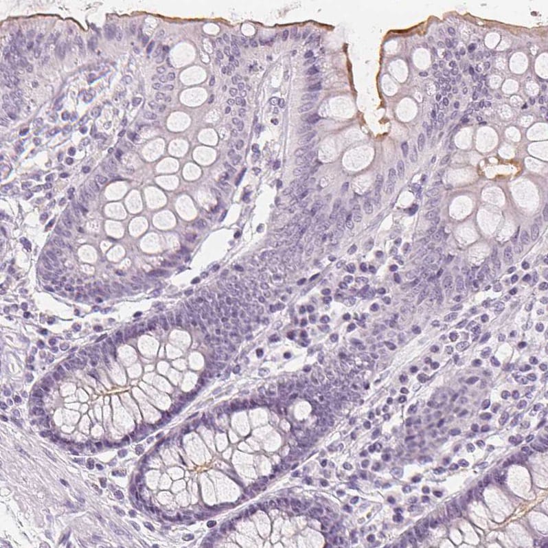 MUC12 Antibody - BSA Free Immunohistochemistry-Paraffin: MUC12 Antibody [NBP1-82607]