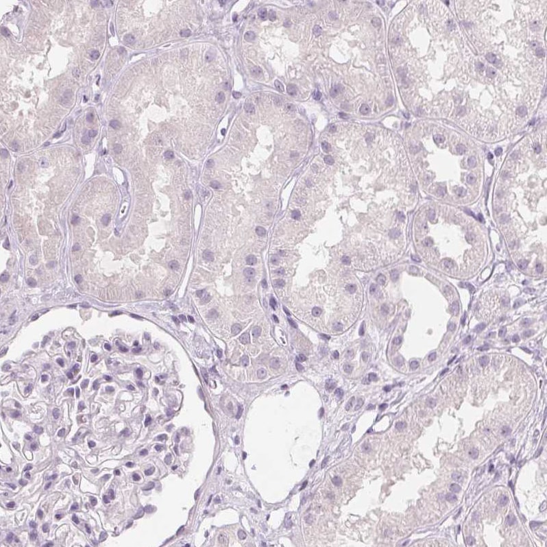 MUC12 Antibody - BSA Free Immunohistochemistry-Paraffin: MUC12 Antibody [NBP1-82607]