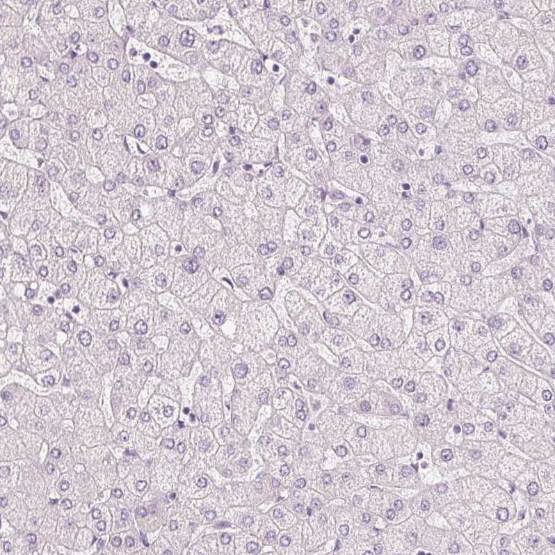 MUC12 Antibody - BSA Free Immunohistochemistry-Paraffin: MUC12 Antibody [NBP1-82607]