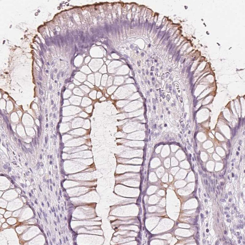 MUC12 Antibody - BSA Free Immunohistochemistry-Paraffin: MUC12 Antibody [NBP1-82607]